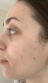 Before - Highly Recommend!